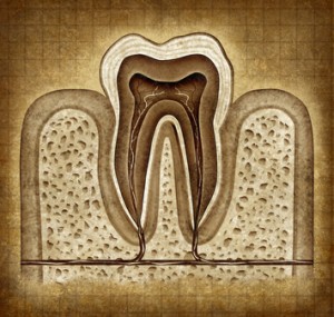 Root Canals Are Root Canals Safe?