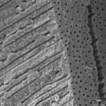 dentinal tubules Dentinal Tubules